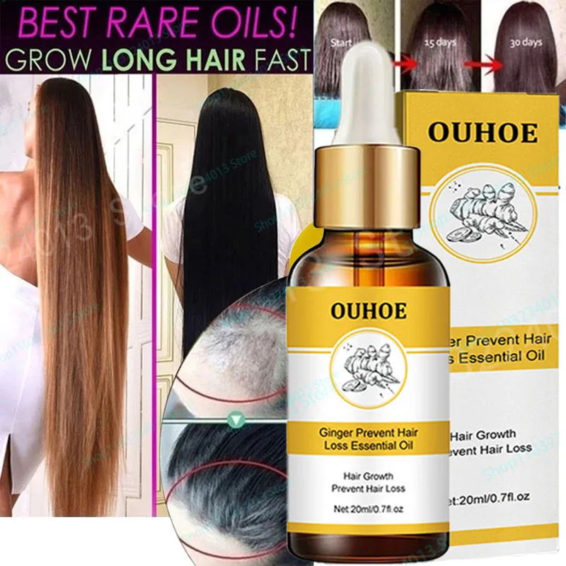7 Days Fast Hair Growth Ginger Growth Hair Oil Treatment Anti Hair Loss Men Women Scalp Treatment Serum Products Beauty Health
