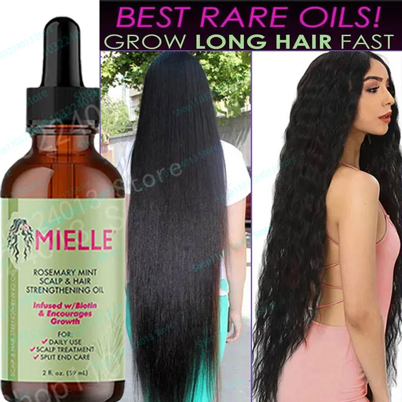Mielle Organics Rosemary Mint Scalp And Hair Enhancement Oil Containing Biotin And Essential Oils Nourishes Split And Dry Scalp