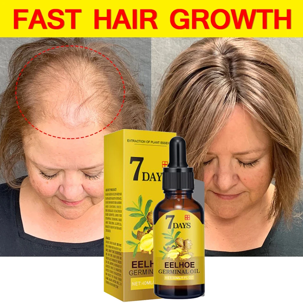 7 Days Ginger Hair Growth Serum Anti-loss Alopecia Treatment Hair Fast Growing Oil Repair Damaged Dry Hair Care for Men Women