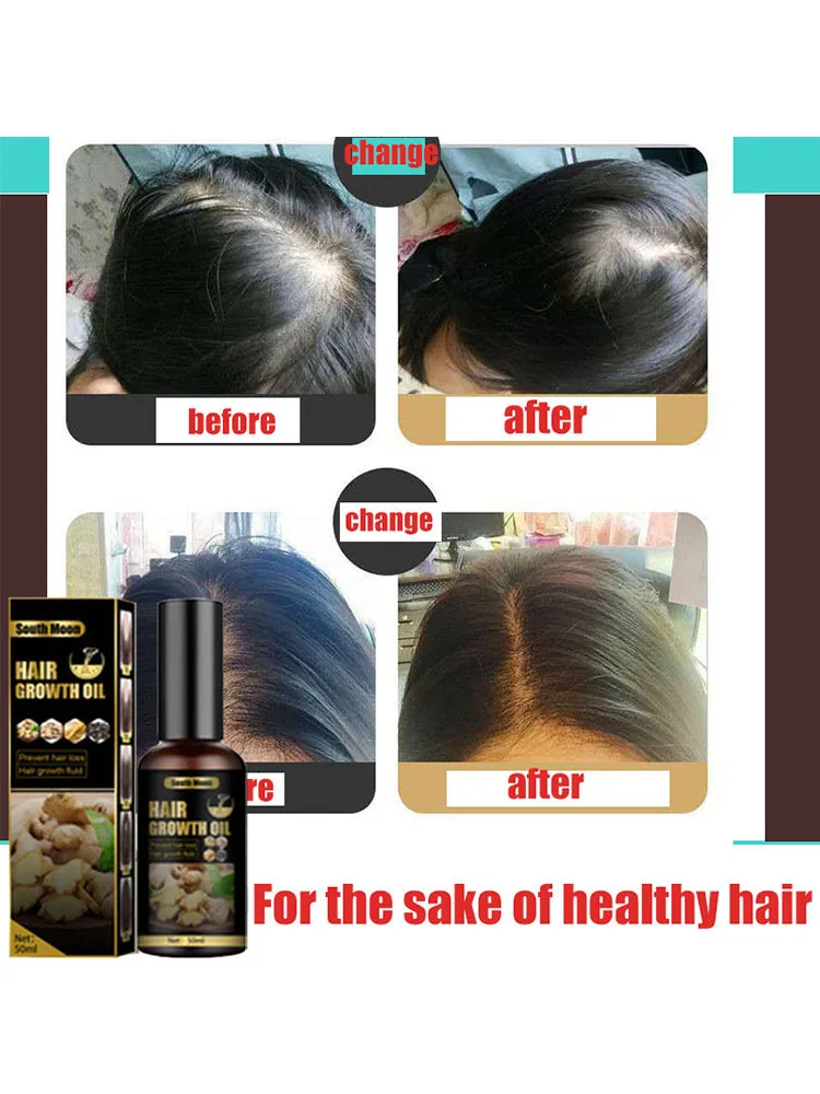 Biotin Fast Hair Growth Oil Hair Regrowth Serum Hair Thinning Treatment Hair Growth Liquid Anti-Hair Loss for Women amp Men