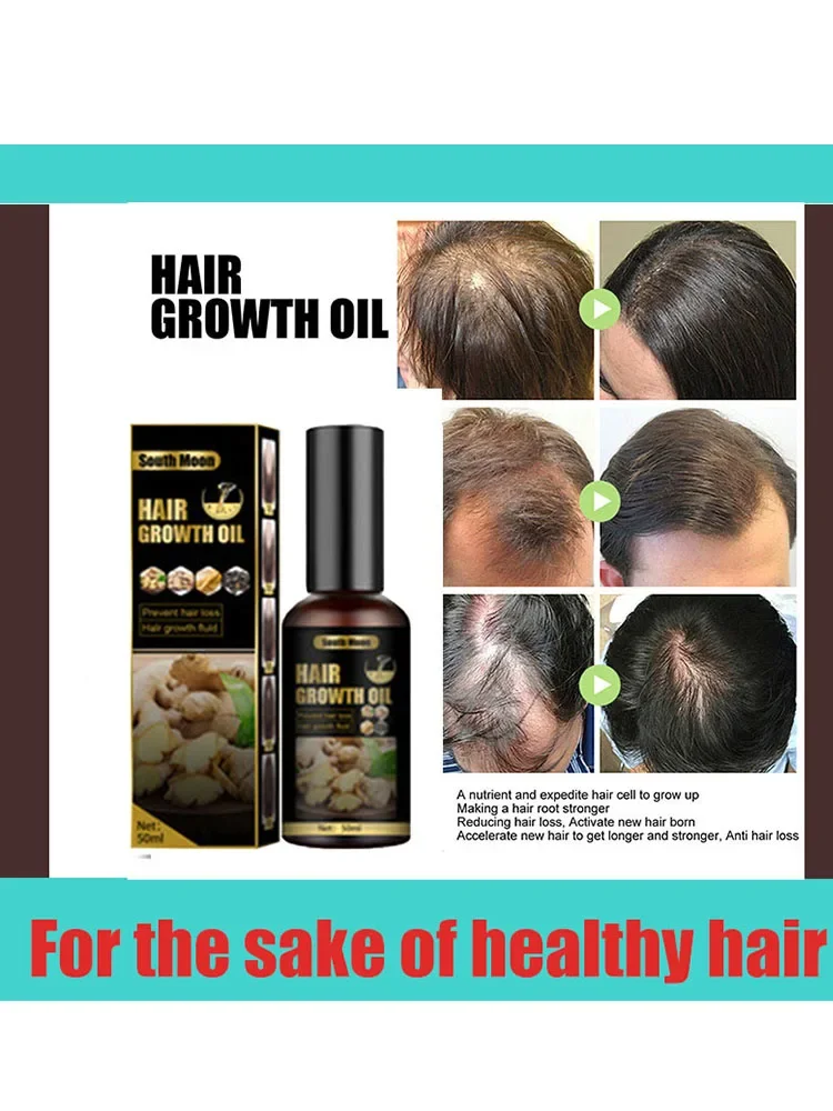 Solves baldness,Anti hair loss spray anti hair loss hair nutrition growth agent essence promotes hair growth,solves baldness.