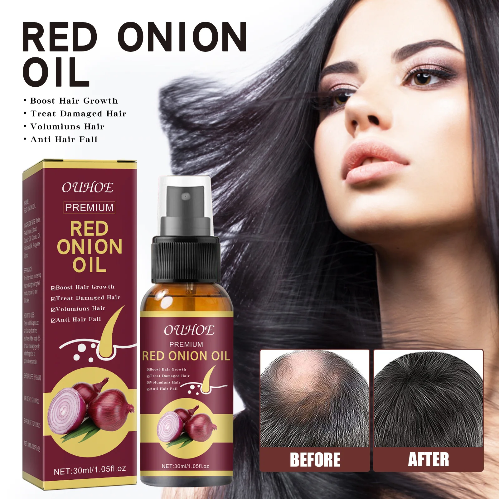 3pcs Onion Black Seed Hair Oil Spray for Natural Hair Care&Growth Prevent Hair Loss Biotin Fast Hair Growth Shampoo Men&Women