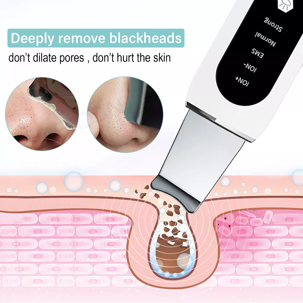 Description Picture 3 of itemUltrasonic Skin Scrubber - Peeling, Blackhead Remover, and Deep Face Cleaning with Ultrasonic Ion Technology for Pore Cleansing