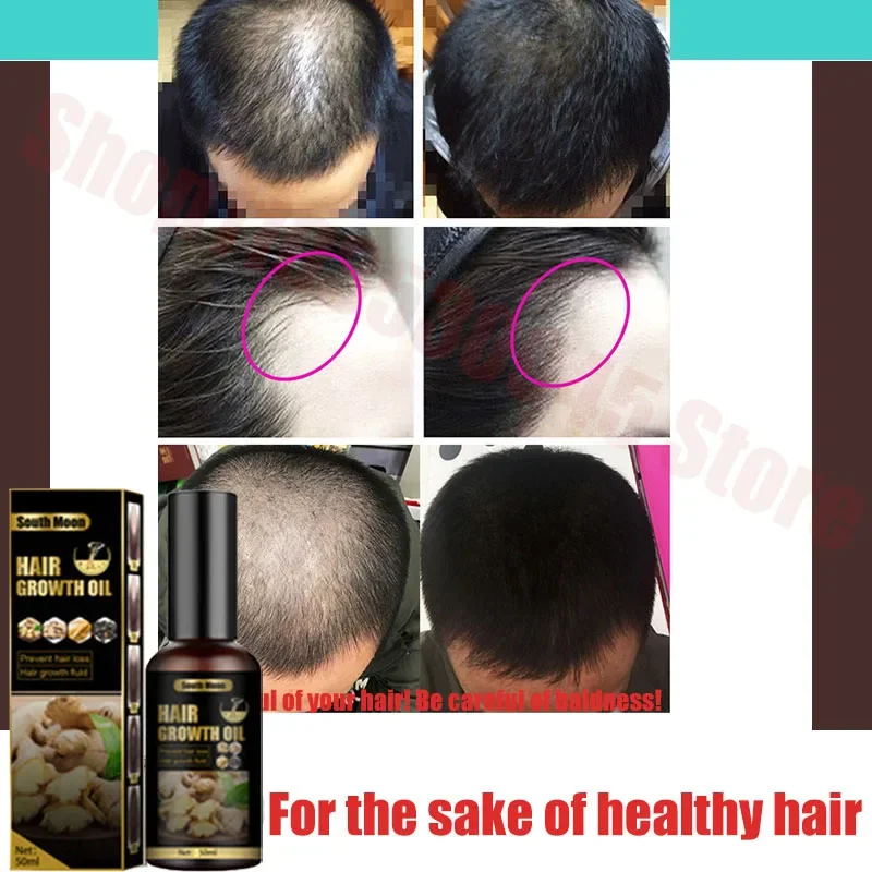 Ginger Hair Growth Spray Strengthening-Hair Massage Scalp Dense-Hair Strengthening Hair Loss Prevention Repair Nourishing Liquid