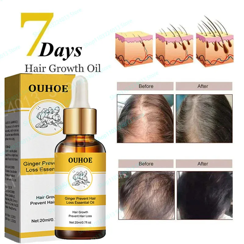 Fast Hair Growth Ginger Growth Hair Oil Treatment Anti Hair Loss Men Women Scalp Treatment Serum Products Beauty Health