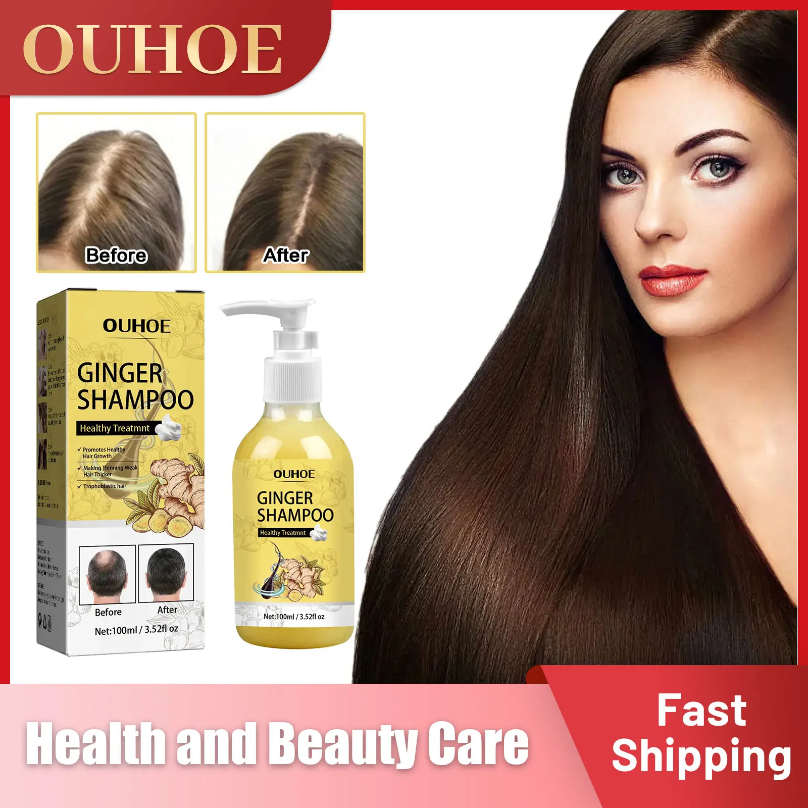 Anti Hair Loss Shampoo Hair Growth Prevent Baldness Repair Scalp Frizz Damage Itch Oil Control Dense Thicker Ginger Hair Shampoo