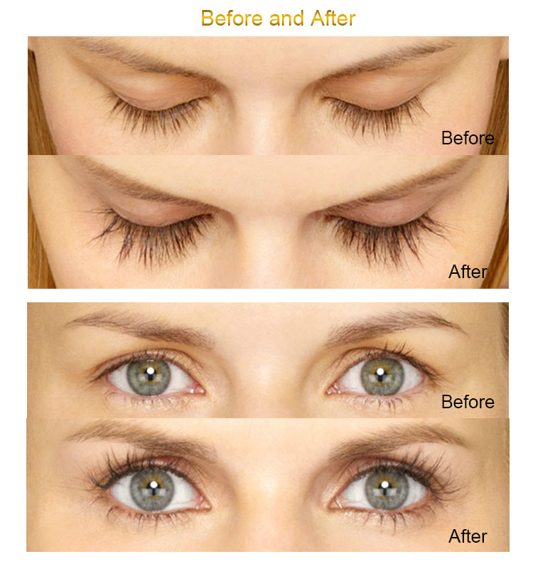 Description Picture 5 of itemFEG Eyelash Enhancer Serum