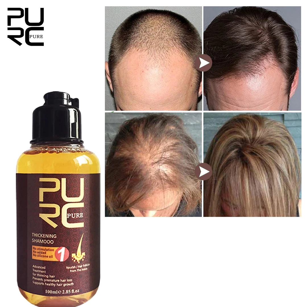 PURC Hair Growth Shampoo Ginger Anti Hair Loss Fast Regrowth Thicken Care Scalp Treatment Hair Grow Products for Men Women