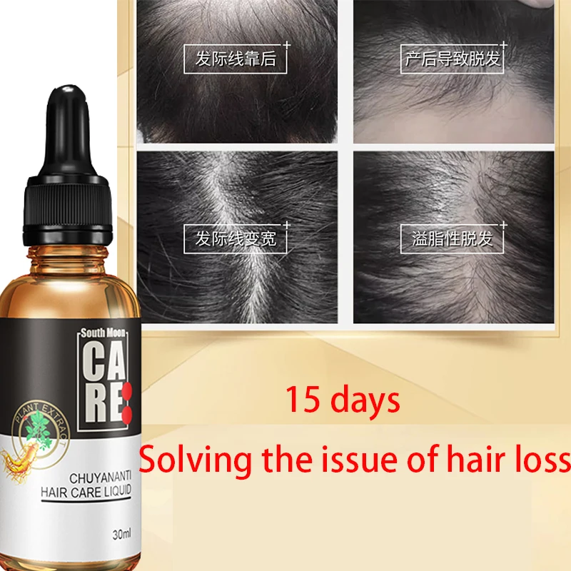 Hair growth solution for preventing hair loss, fixing and densifying hair, magical hairline, hair growth and growth
