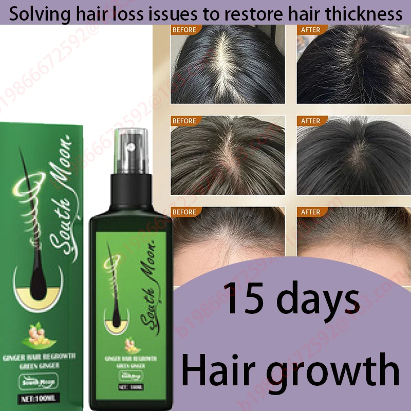 Hair Growth Essential Oil Rosemary Mint Hair Strengthening Oil Treatment Dry Mielle Organics Split Ends Hair Essential Oil