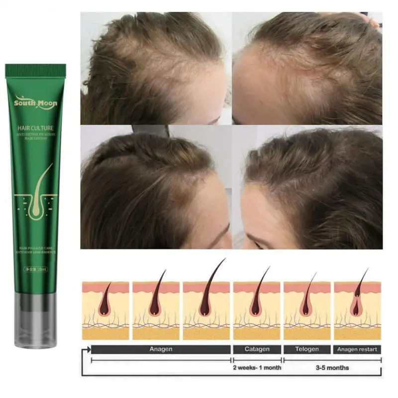Fast Hair Growth Oil Hair Regrowth Serum Hair Thinning Hair Growth Liquid Anti-Hair Loss For Women And Men Hair Loss Product