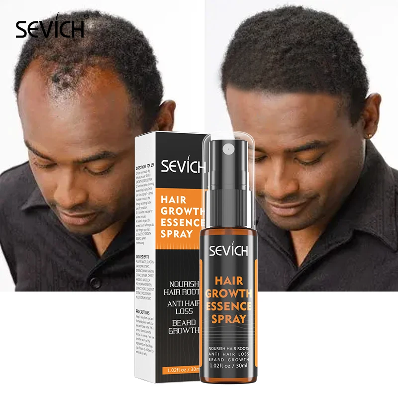 Ginger Essence Hair Growth Products Fast Regrowth Oil Serum Hair Loss Medicine Enhancer Care Beauty Scalp Treatment Sevich