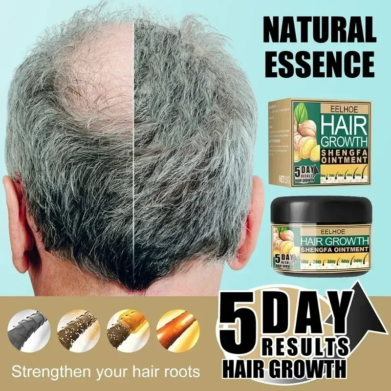 Sdottor New Hair Mask Ginger Hair Growth Moroccan Germination Cream Hair Repair Cream Contains Oil Care Anti-hair Loss Product