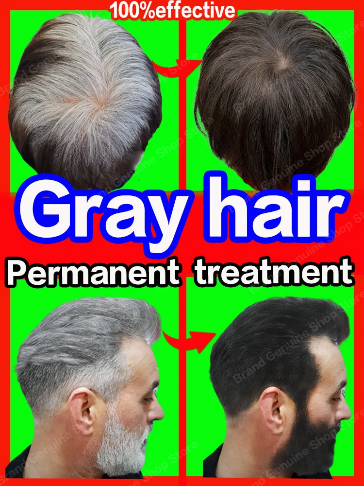 Anti Gray Hair Serum Remedy