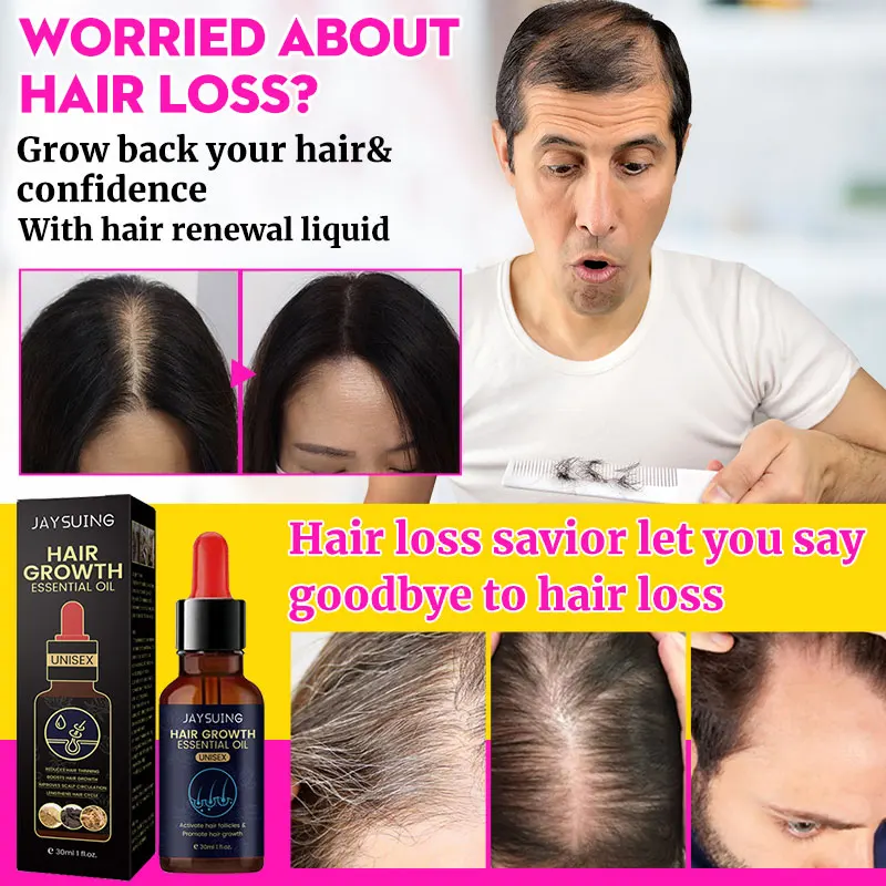 Hair Follicle Repair Hair Growth Plant Essence Oil Rapid Anti-Hair loss Regeneration Sssence Product Treatment Hair Scalp Care